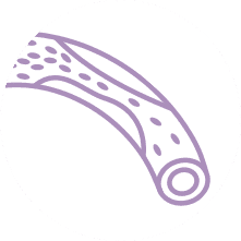 Dislipidemia