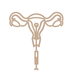 Inseminação IntraUterina